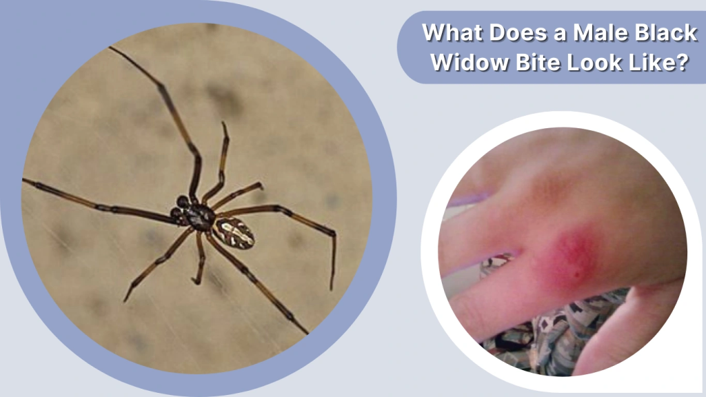 What Does a Male Black Widow Bite Look Like