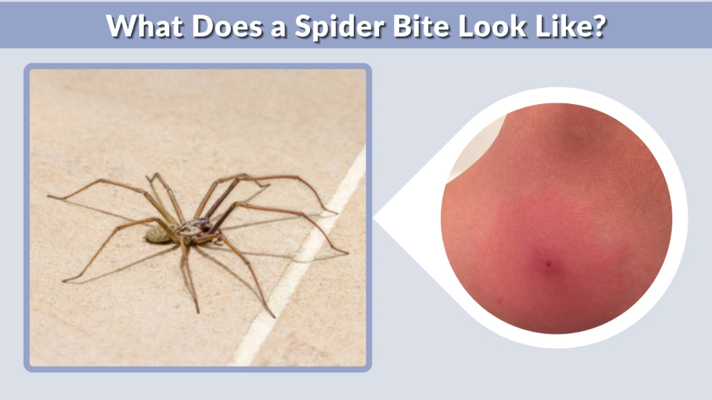 What Does a Spider Bite Look Like
