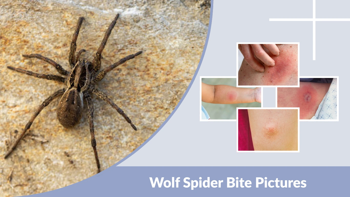 Wolf Spider Bite Pictures What a Wolf Spider Bite Looks Like