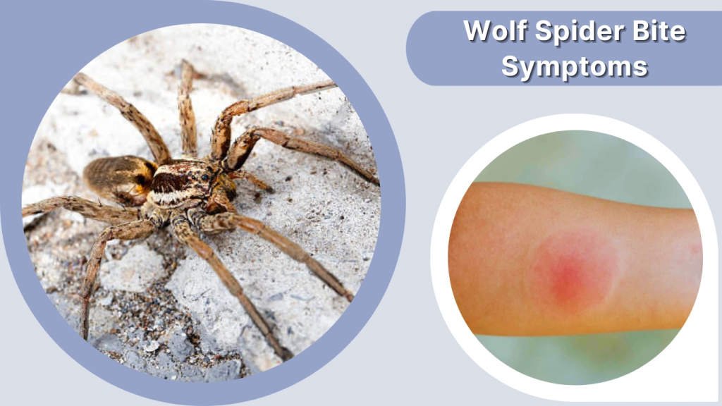 Wolf Spider Bite Symptoms
