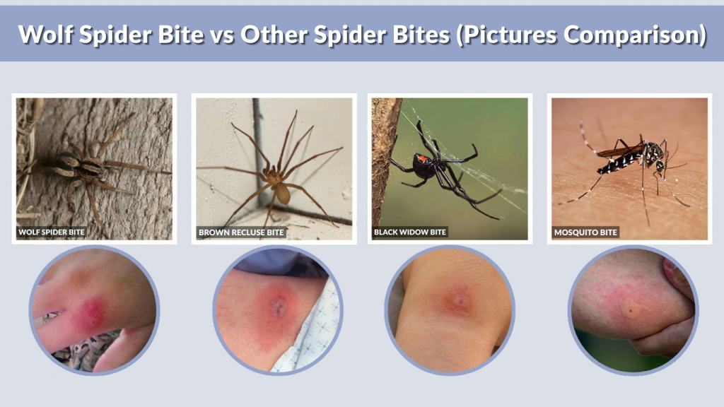 Wolf Spider Bite vs Other Spider Bites (Pictures Comparison)