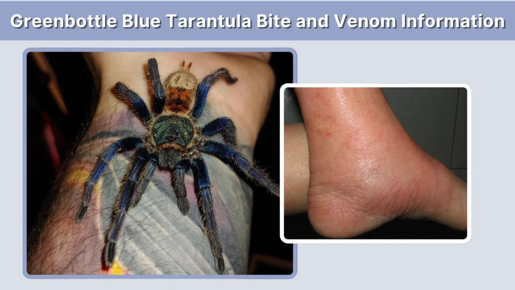 Greenbottle Blue Tarantula Bite and Venom Information