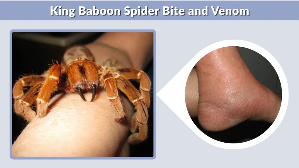 King Baboon Spider Bite and Venom