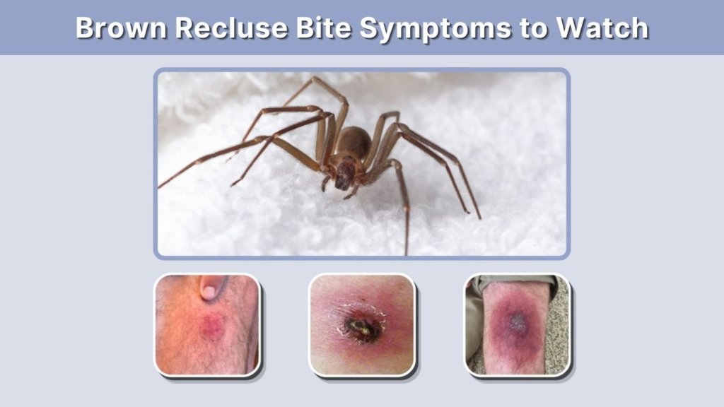 Brown Recluse Bite Symptoms to Watch