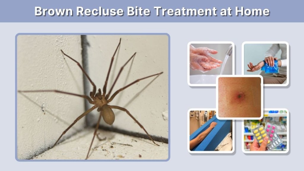 Brown Recluse Bite Treatment at Home