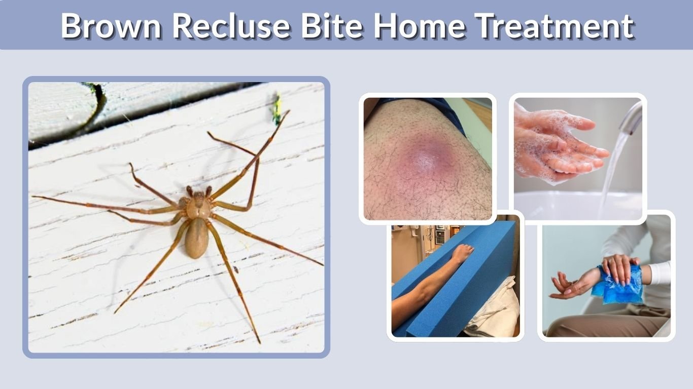 Brown Recluse Bite Home Treatment: What to Do First