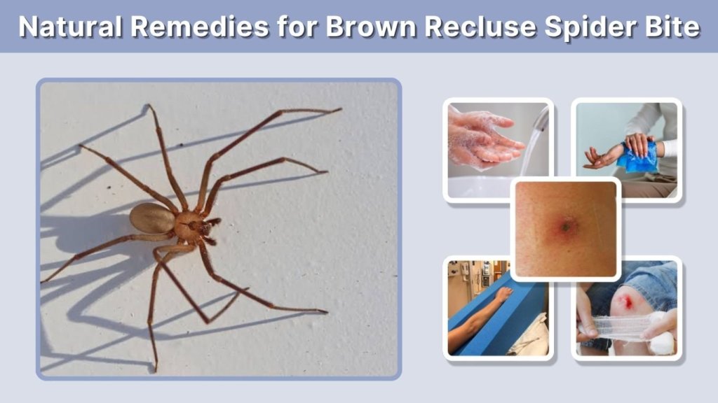 Natural Remedies for Brown Recluse Spider Bite