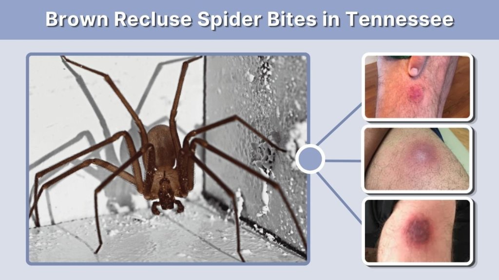Brown Recluse Spider Bites in Tennessee